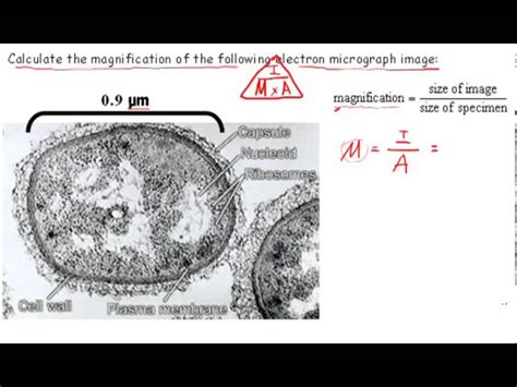 magnification questions a-level biology.